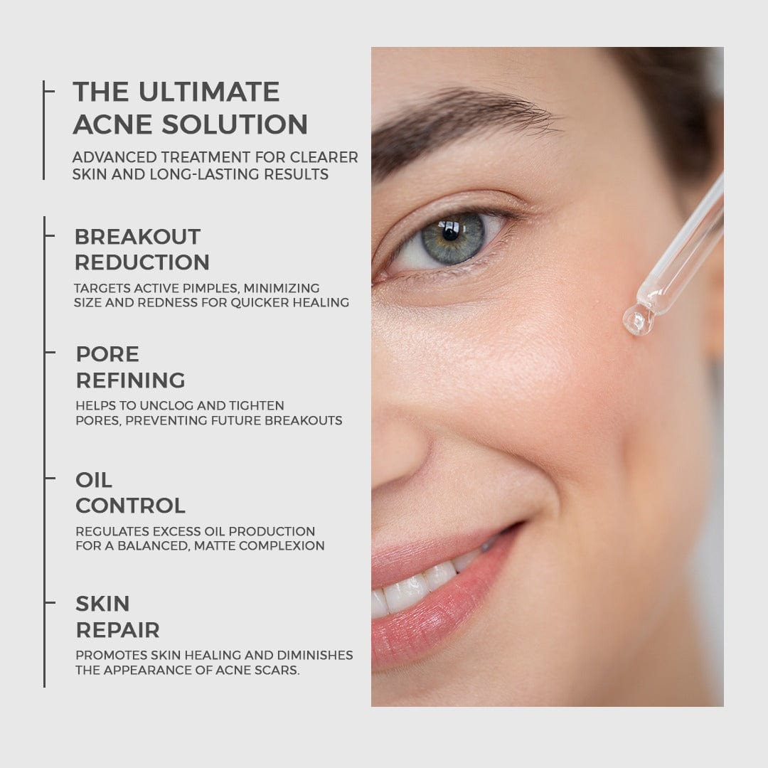 Advanced Acne Treatment